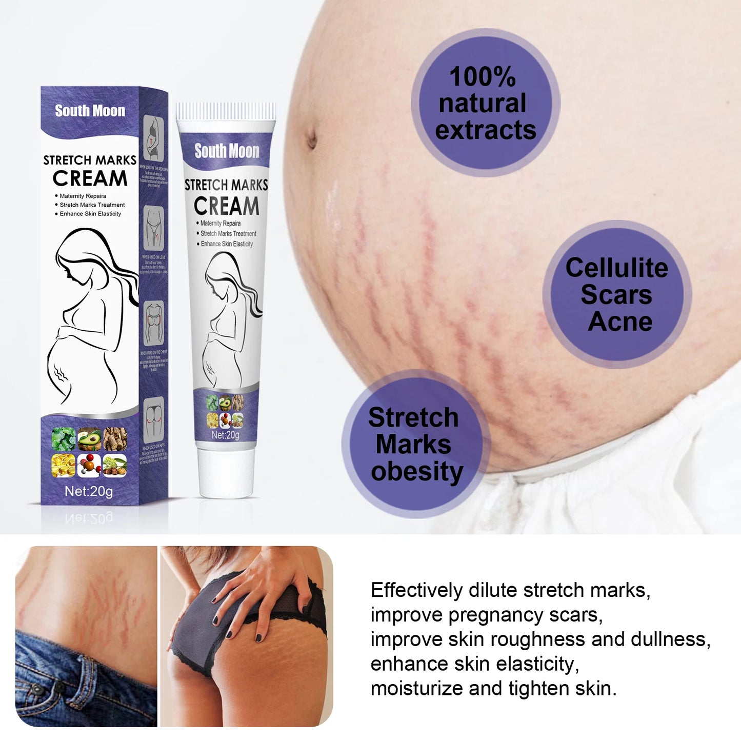 Crema para eliminar estrías del embarazo – Mejora la elasticidad, difumina líneas de crecimiento, suaviza, nutre, humecta y reafirma – Cuidado de la piel